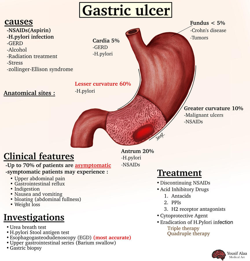 Gastric ulcer